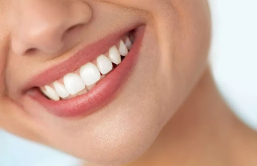 Yellow Teeth? No Problem! Simple Solutions to Brighten Your Smile